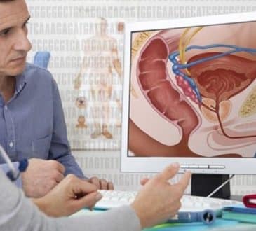 Qu'est-ce qu'un cancer de la prostate et quelles en sont les causes