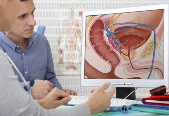 Qu'est-ce qu'un cancer de la prostate et quelles en sont les causes