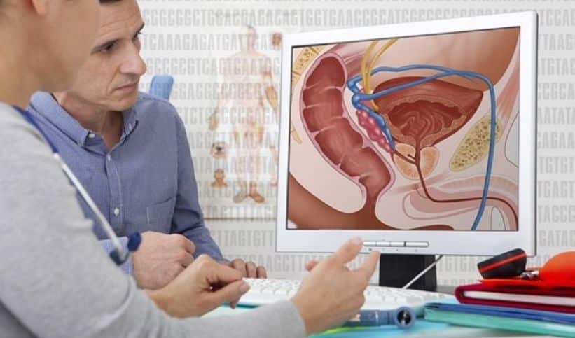 Qu'est-ce qu'un cancer de la prostate et quelles en sont les causes