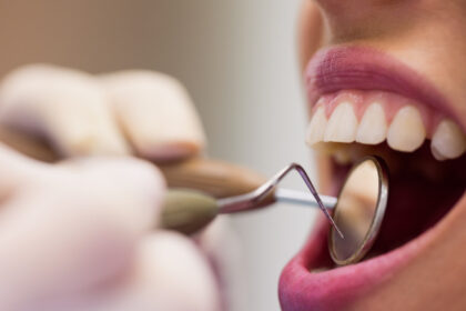 Votre sourire, votre priorité : choisissez un dentiste de confiance à Lyon